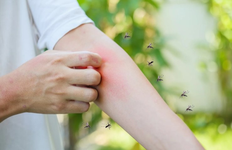 Punture di zanzare 